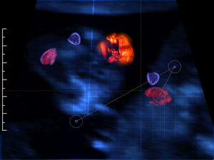 Fig 6A